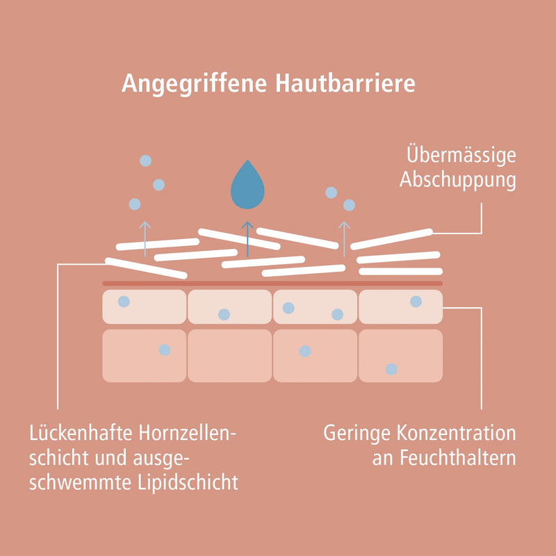 NEU  VICOPURA REPIDOUX Spezialcreme zur Intensiv Pflege verhornter, schuppiger Haut an Füssen, Ellbogen, Händen, Körper